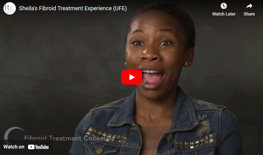 Sheil-youtube-image Sheila's Fibroid Treatment Experience (UFE)